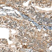 兔抗CALHM1多克隆抗体