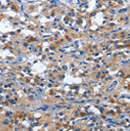 兔抗CD177多克隆抗体