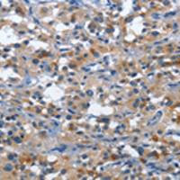 兔抗CD177多克隆抗体