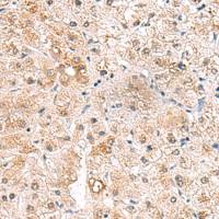 兔抗RTKN2多克隆抗体