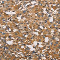 兔抗NPPA多克隆抗体