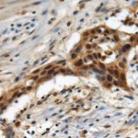 兔抗EIF3G多克隆抗体