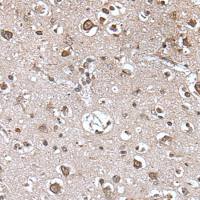 兔抗TRIM27多克隆抗体