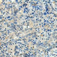 兔抗FBXL16多克隆抗体