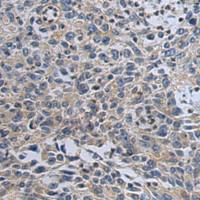 兔抗UBA7多克隆抗体