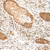 兔抗MKX多克隆抗体