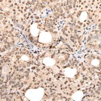 兔抗ZSCAN12多克隆抗体