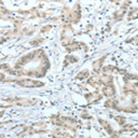 兔抗ASH2L多克隆抗体