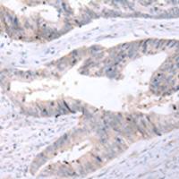 兔抗P2RY12多克隆抗体