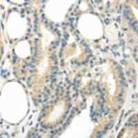 兔抗WNT6多克隆抗体