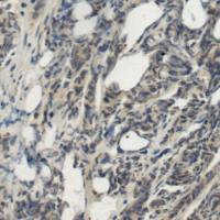 兔抗MASP1多克隆抗体