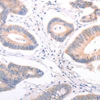 兔抗F9多克隆抗体