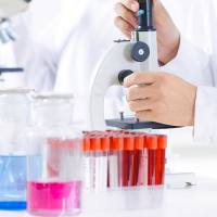 外泌体粒径检测（NTA）