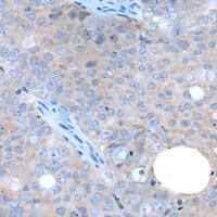 兔抗WAPL多克隆抗体