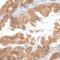 兔抗CASZ1多克隆抗体