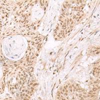 兔抗ESPN多克隆抗体