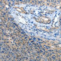 兔抗ATP1A1多克隆抗体