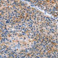 兔抗ALS2多克隆抗体