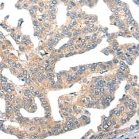 兔抗GPR55多克隆抗体