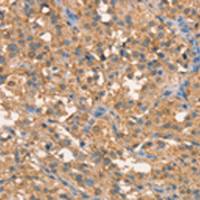 兔抗CRELD1多克隆抗体