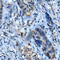 兔抗UFC1多克隆抗体