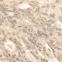 兔抗BCAS3多克隆抗体