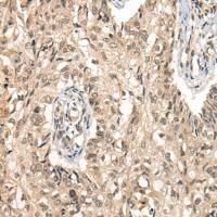 兔抗CDC14B多克隆抗体