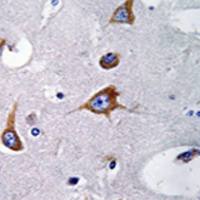 兔抗CHSY1多克隆抗体