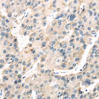 兔抗TXNIP多克隆抗体