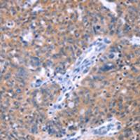 兔抗ZNF395多克隆抗体