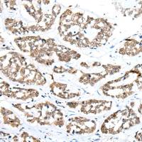 兔抗ZNRD1多克隆抗体