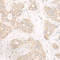 兔抗TRMT1多克隆抗体