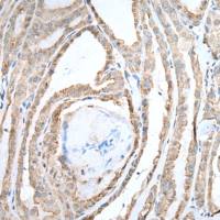 兔抗UBE2C多克隆抗体