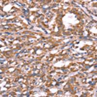 兔抗SPAST多克隆抗体