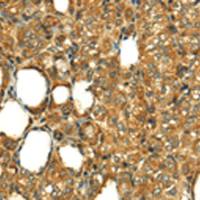 兔抗RLN1多克隆抗体