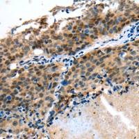 兔抗MYBPHL多克隆抗体