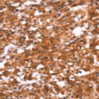 兔抗GABRA1多克隆抗体