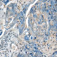 兔抗CCM2多克隆抗体