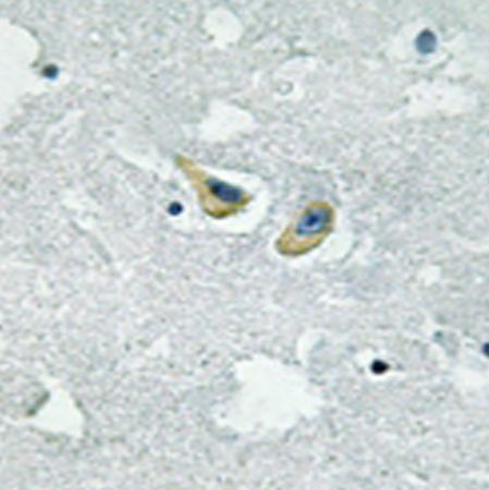 兔抗NCF1(Phospho-Ser345) 多克隆抗体