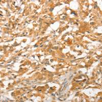 兔抗APTX多克隆抗体