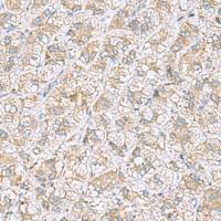 兔抗NDRG4多克隆抗体