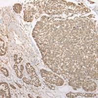 兔抗CFAP410多克隆抗体