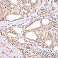 兔抗ARL17A/ARL17B多克隆抗体