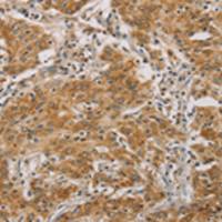 兔抗CDKN2A多克隆抗体