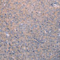 兔抗ANKRD26多克隆抗体