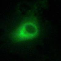 兔抗GRK6多克隆抗体