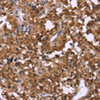 兔抗GPR171多克隆抗体