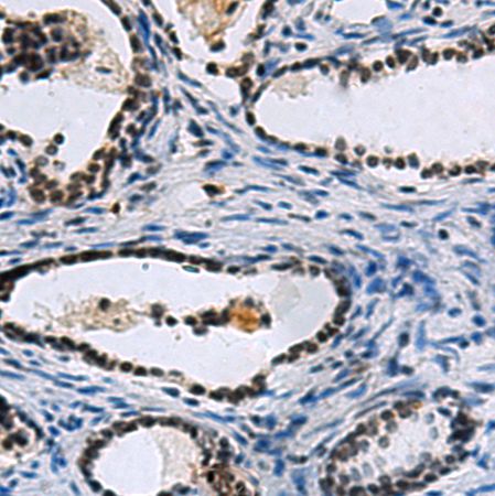 兔抗CCAR2多克隆抗体