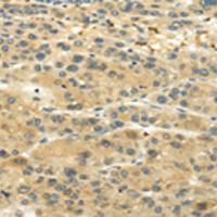 兔抗UGT1A6多克隆抗体