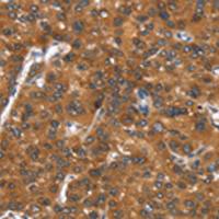 兔抗CADM4多克隆抗体